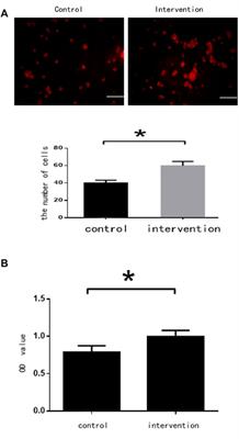 Phosphatase and Tensin Homology Deleted on Chromosome 10 Inhibitors Promote Neural Stem Cell Proliferation and Differentiation